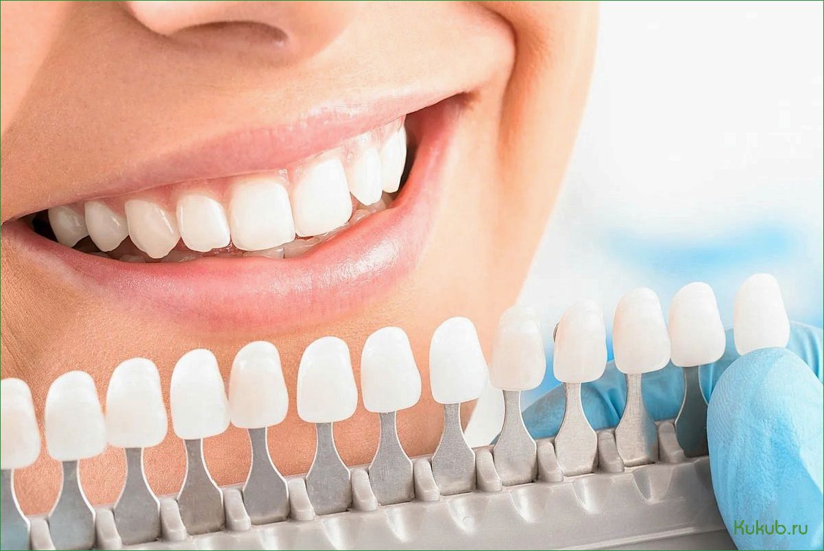 Эстетическая стоматология в клинике Династия: Секреты создания идеальной улыбки